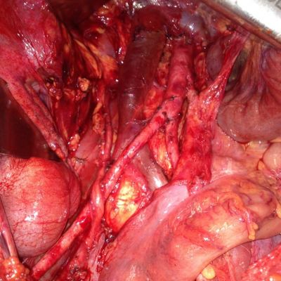 Anatomia Posterior1 Min
