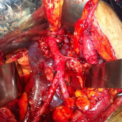 Renal Posterior Min